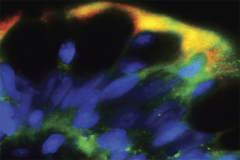 Cover art of American Journal of Physiology from 2010